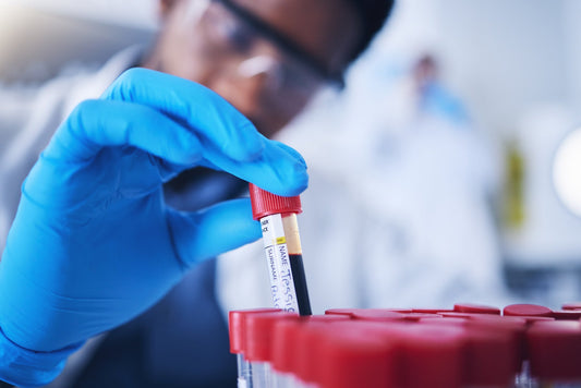 The Different types of HIV testing available in the UK - Everything you need to know
